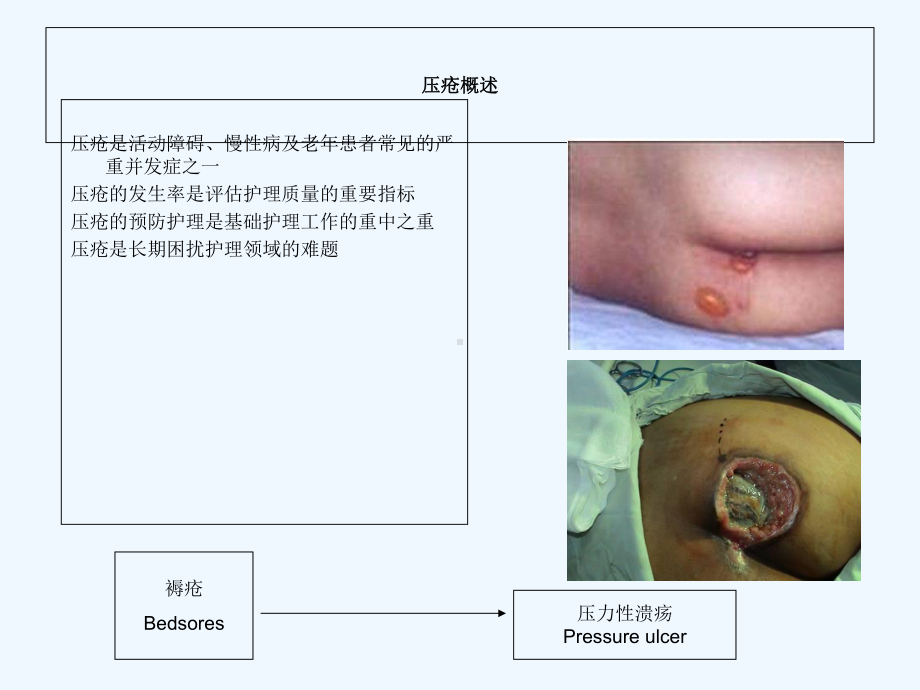 压疮护理进展与指南课件.ppt_第3页