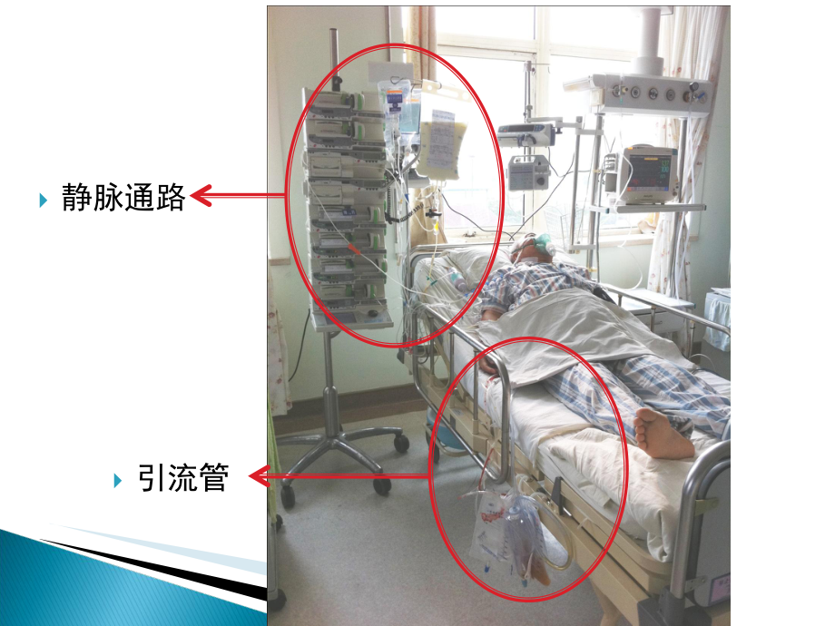 医学课件管道滑脱的预防和应急程序.ppt_第1页