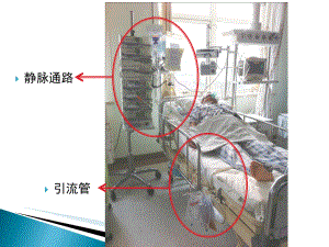 医学课件管道滑脱的预防和应急程序.ppt