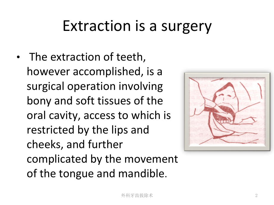 外科牙齿拔除术培训课件.ppt_第2页