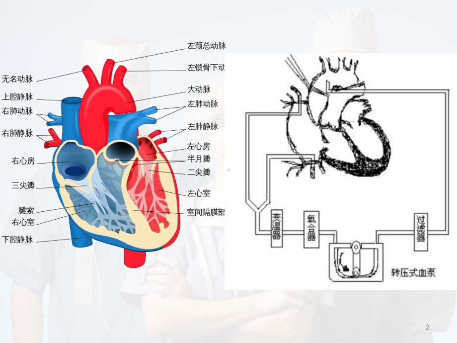 医学课件-心脏手术麻醉的一般流程课件.pptx_第2页