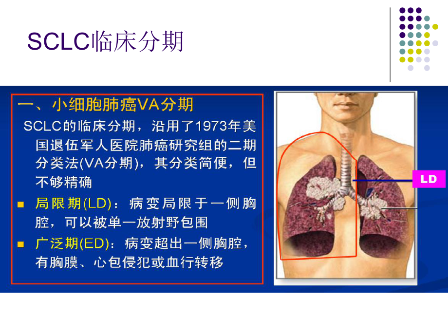 小细胞肺癌指南解读培训课件.ppt_第3页