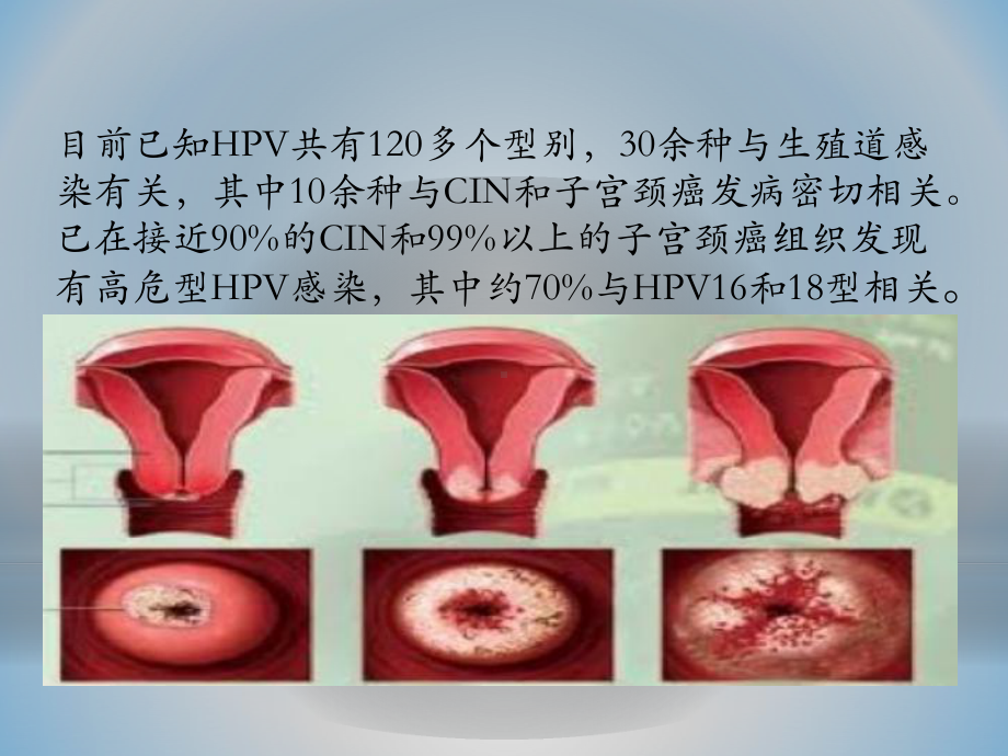 宫颈癌疫苗与HPV课件.pptx_第3页