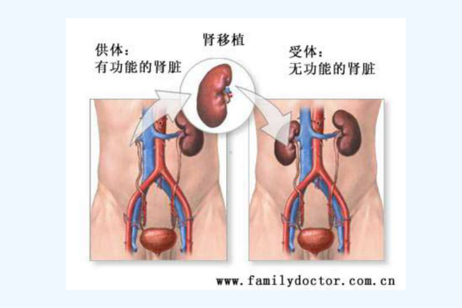 大学课件常见器官移植手术的麻醉.ppt_第3页