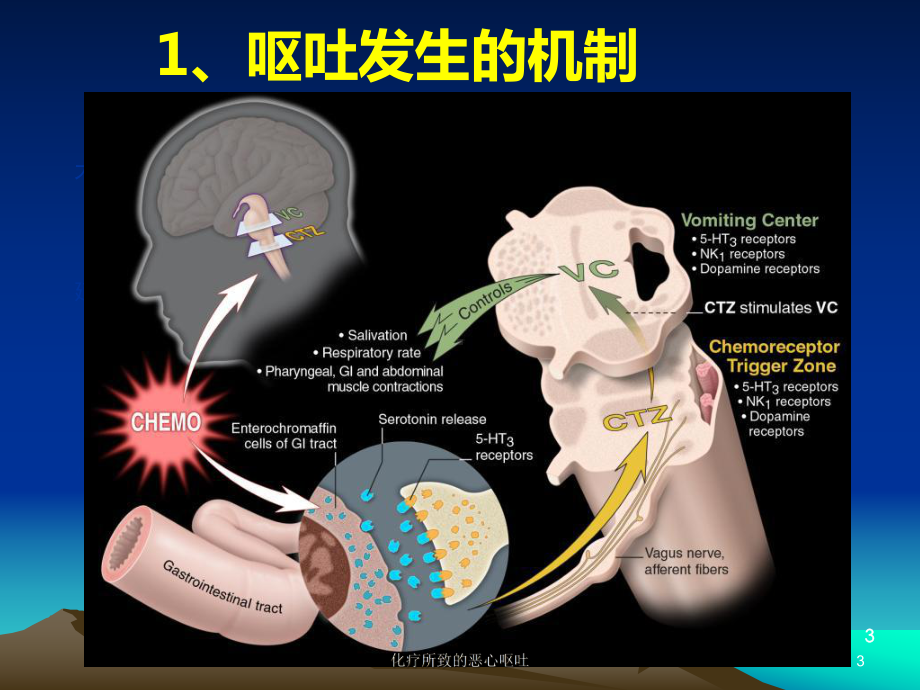 化疗所致的恶心呕吐培训课件.ppt_第3页