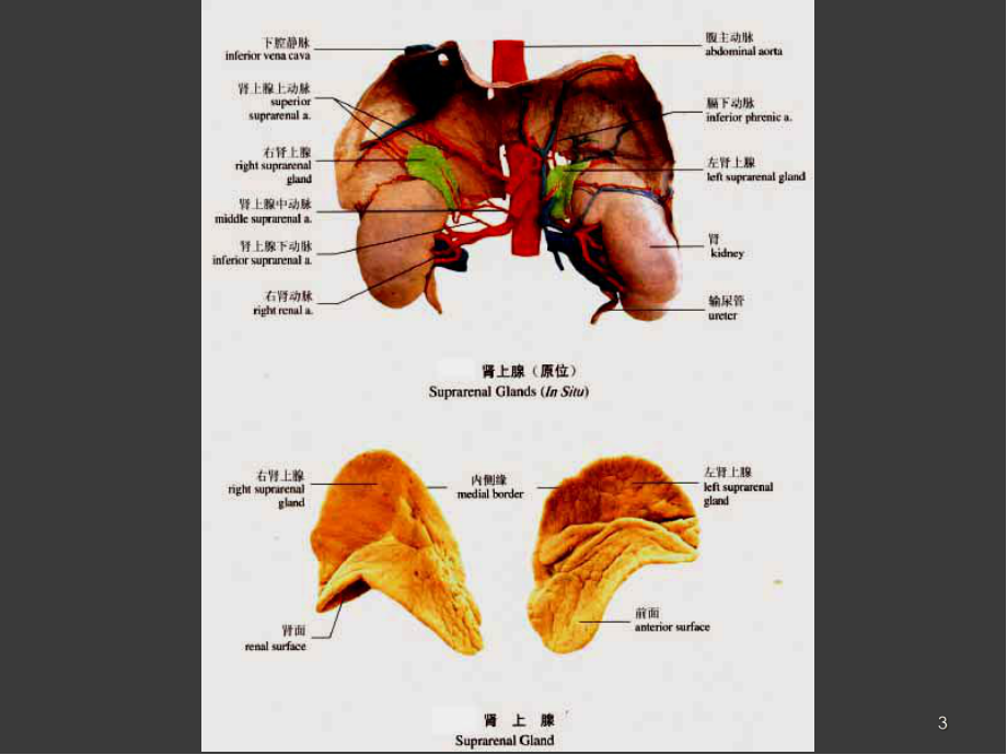 医学课件-肾上腺疾病的影像学诊断课件.ppt_第3页