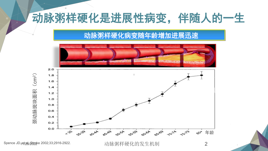 动脉粥样硬化的发生机制课件.ppt_第2页