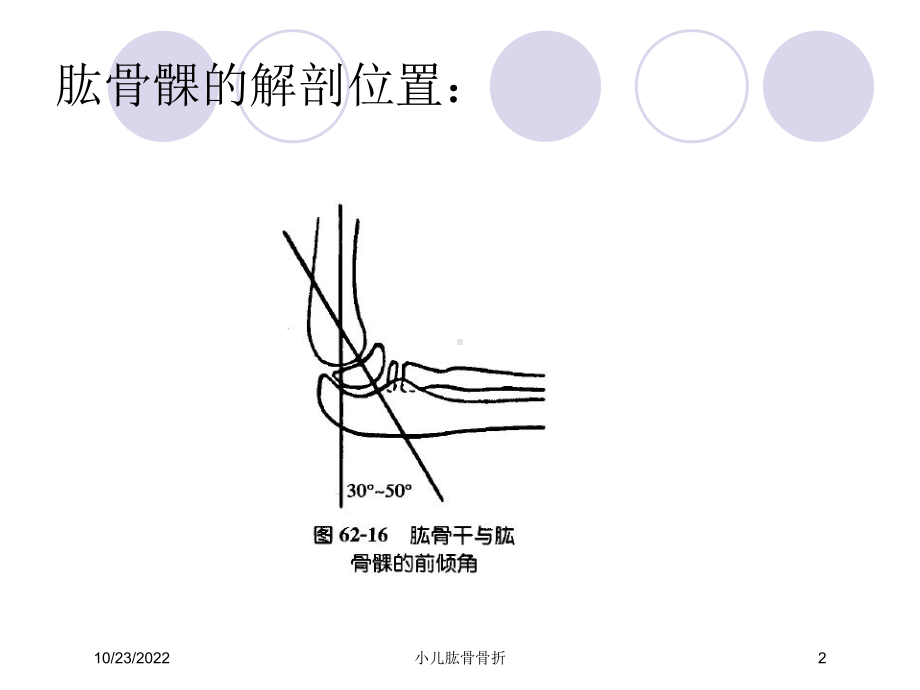 小儿肱骨骨折课件.ppt_第2页