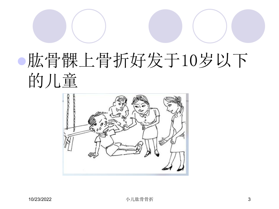 小儿肱骨骨折课件.ppt_第3页