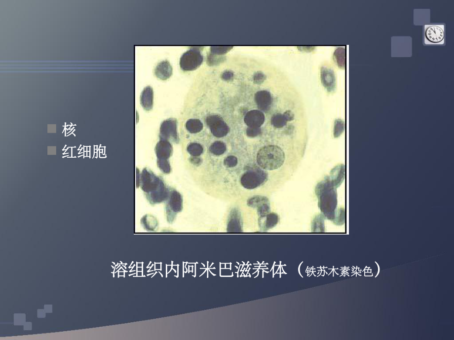 寄生虫实验考图片解说课件-2.ppt_第3页