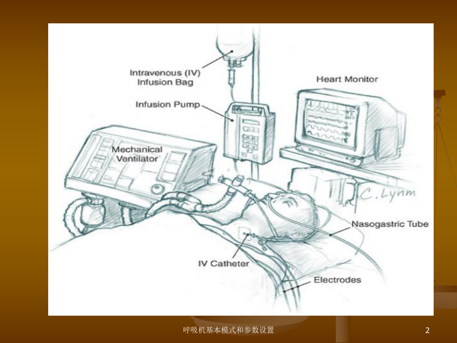 呼吸机基本模式和参数设置培训课件.ppt_第2页