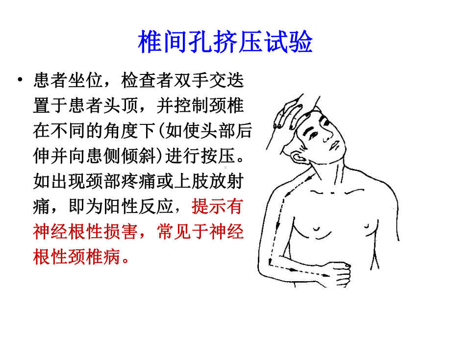 医学外科阳性体征培训课件.ppt_第2页