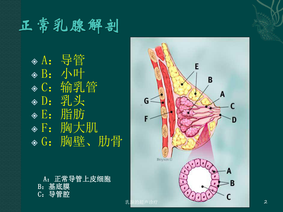 乳腺的超声诊疗培训课件.ppt_第2页