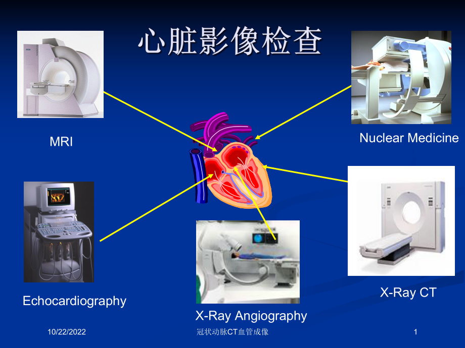 冠状动脉CT血管成像课件.ppt_第1页