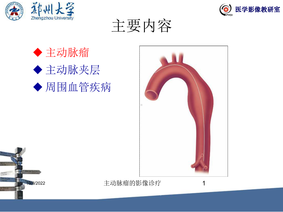 主动脉瘤的影像诊疗课件.ppt_第1页