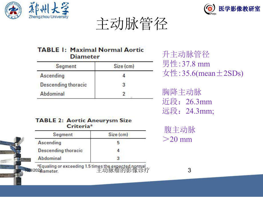 主动脉瘤的影像诊疗课件.ppt_第3页