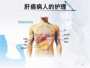 医学课件-肝癌病人的护理课件.ppt