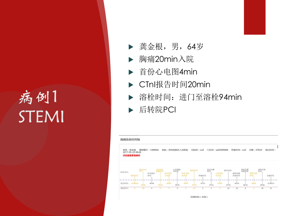 医学胸痛中心质量分析培训课件.ppt_第2页