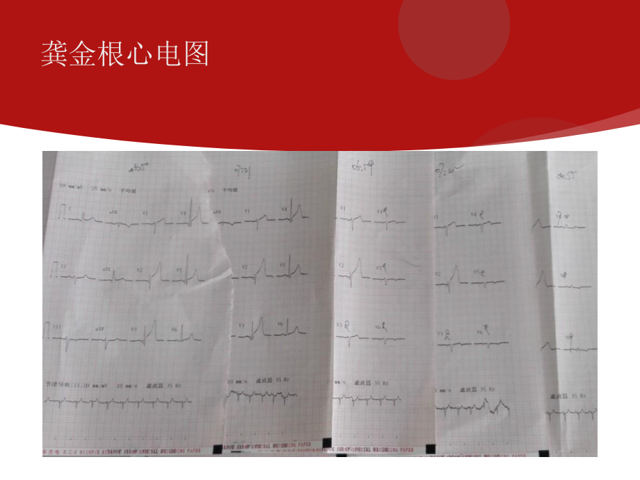 医学胸痛中心质量分析培训课件.ppt_第3页