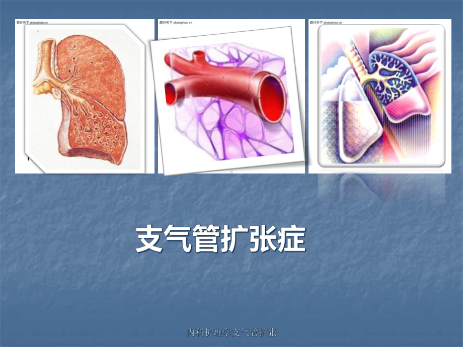 内科护理学支气管扩张课件.ppt_第1页