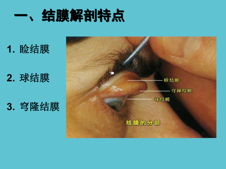 五官科学第三章眼科常见疾病结膜病一结膜炎课件.ppt_第2页