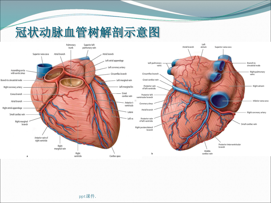 冠状动脉造影识图课件-2.ppt_第2页