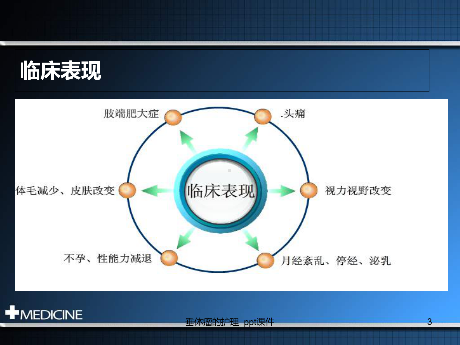 垂体瘤的护理-课件.ppt_第3页