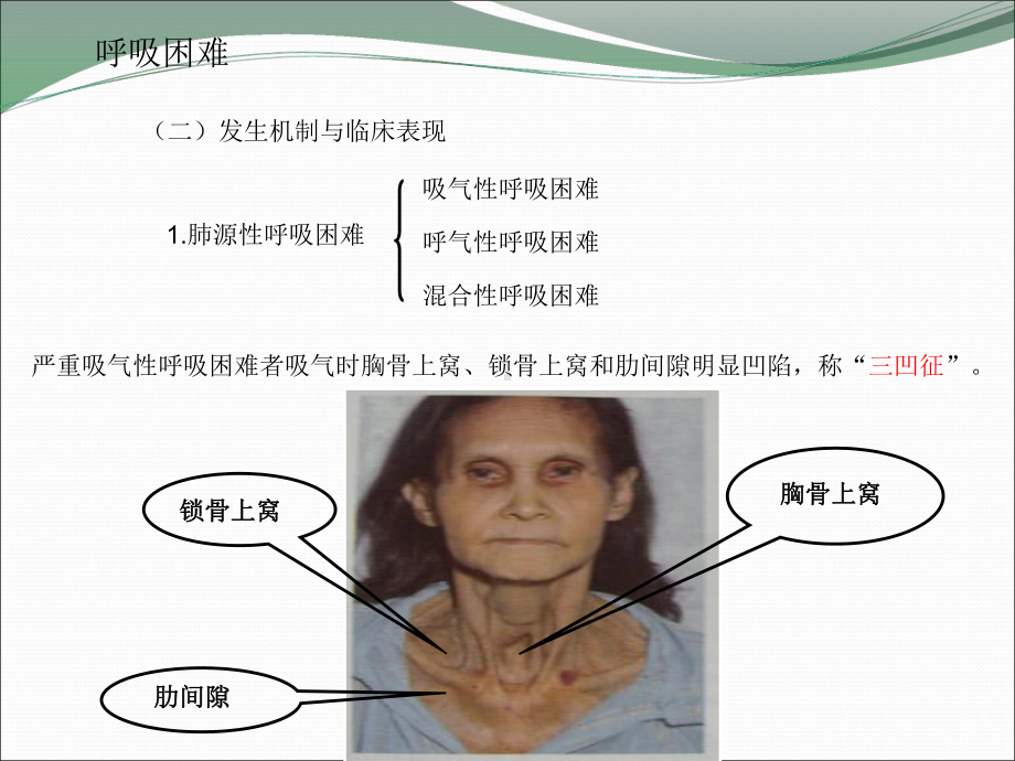 健康评估呼吸困难咳嗽咯血课件.ppt_第3页