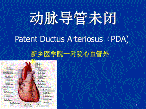 动脉导管未闭护理课件.ppt