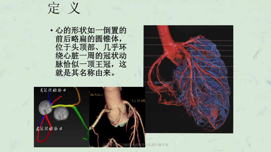 冠脉解剖与CTA最简单最容易记忆图片最丰富课件.ppt_第2页