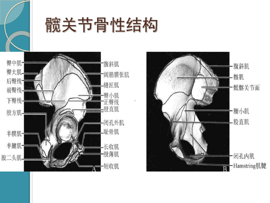 医学课件髋关节MRI检查与常见病诊断.ppt_第3页