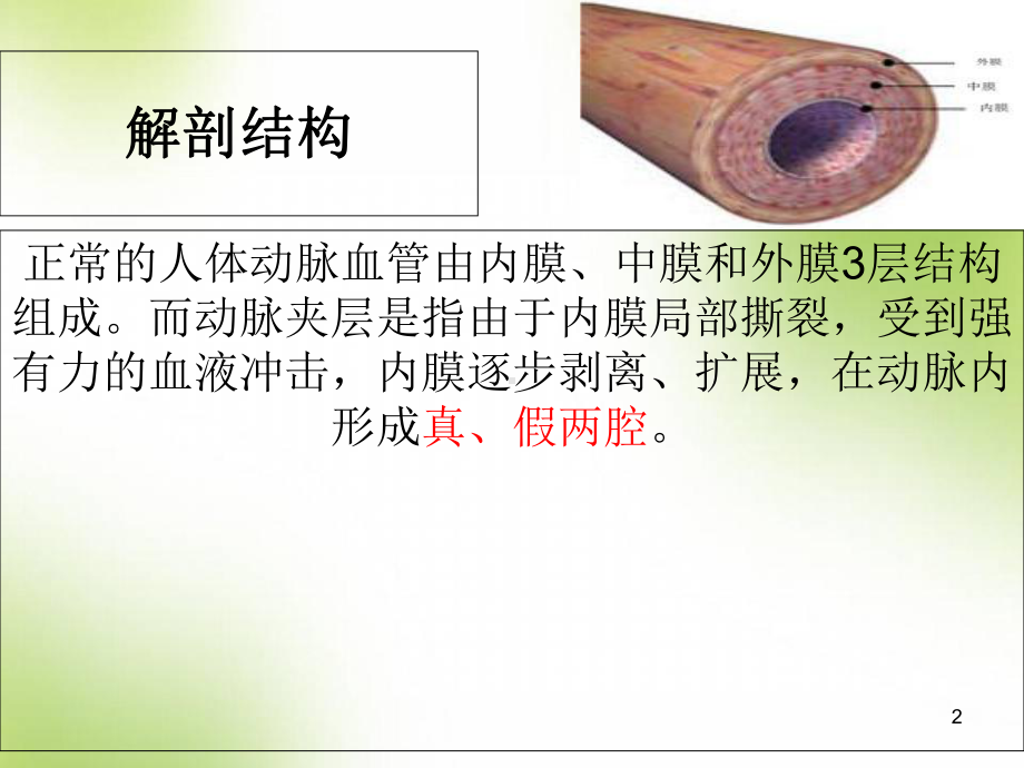 医学课件-主动脉夹层课件-2.ppt_第2页