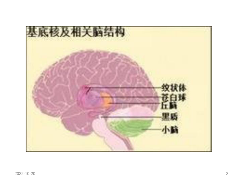 基底节区解剖位置关系图及临床优质课件.ppt_第3页