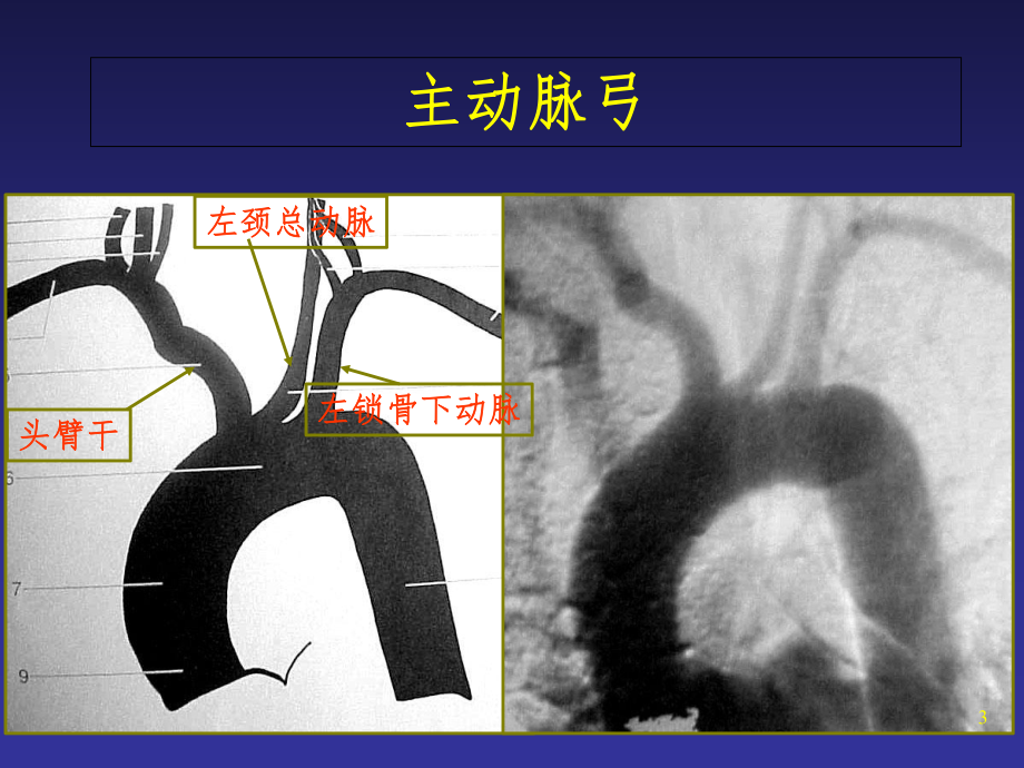 头颈部动脉解剖课件.ppt_第3页