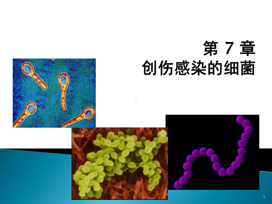 创伤感染细菌课件.pptx_第1页