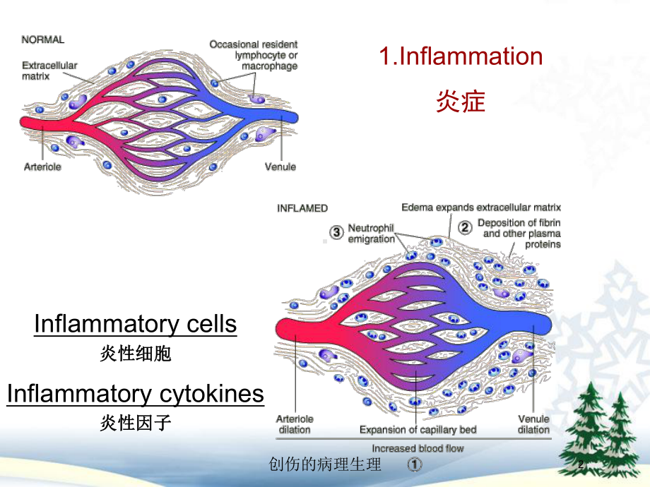 创伤的病理生理培训课件.ppt_第2页