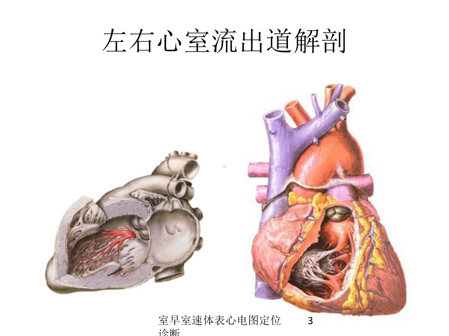 室早室速体表心电图定位诊断培训课件.ppt_第3页