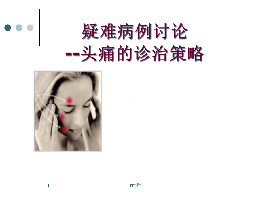 头痛讲课课件.ppt_第1页