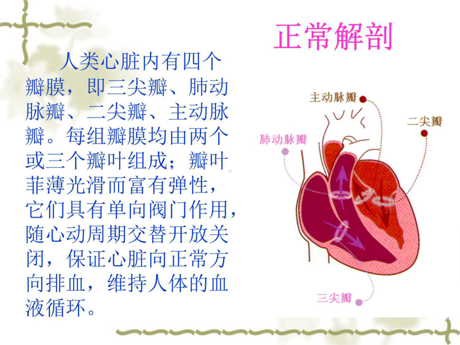 主动脉瓣置换术后的护理11-课件.pptx_第2页