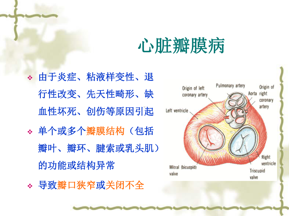 主动脉瓣置换术后的护理11-课件.pptx_第3页