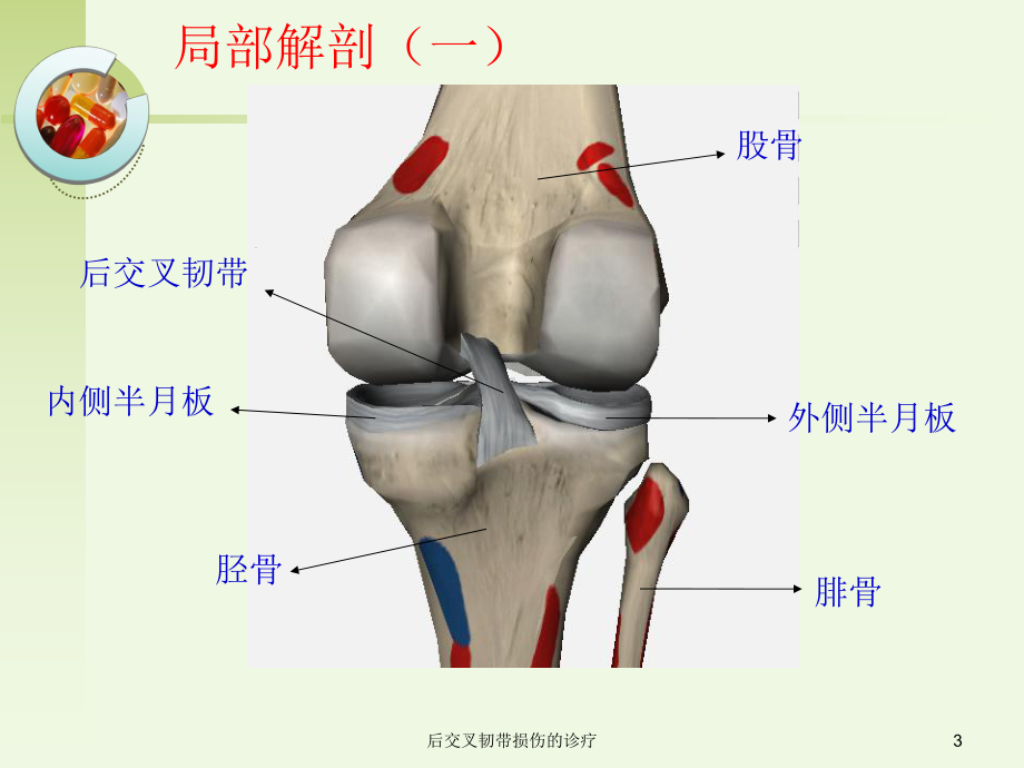 后交叉韧带损伤的诊疗培训课件.ppt_第3页