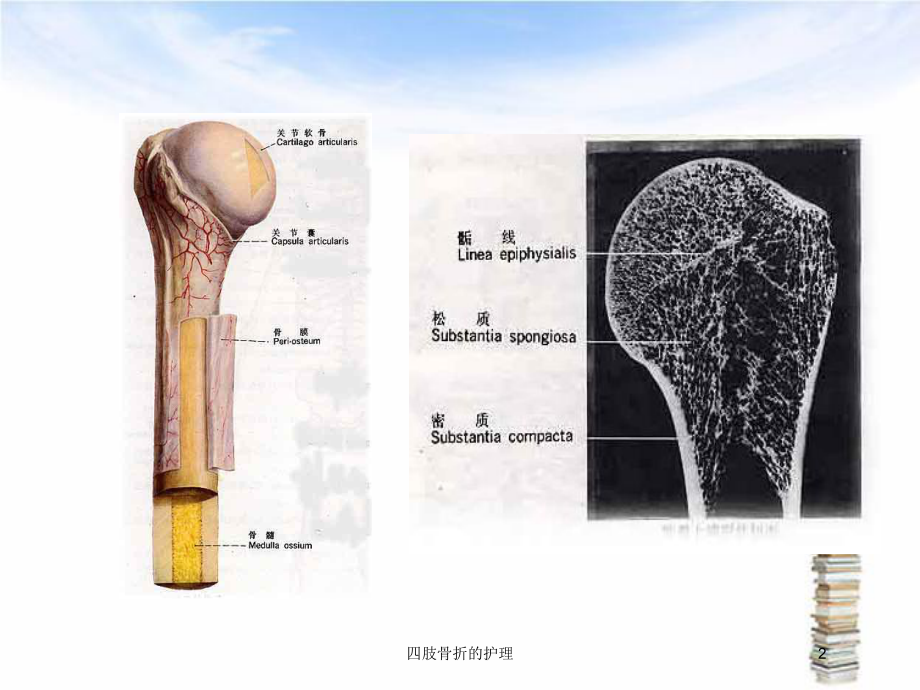 四肢骨折的护理培训课件.ppt_第2页