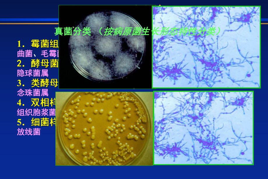 侵袭性真菌感染课件.pptx_第2页