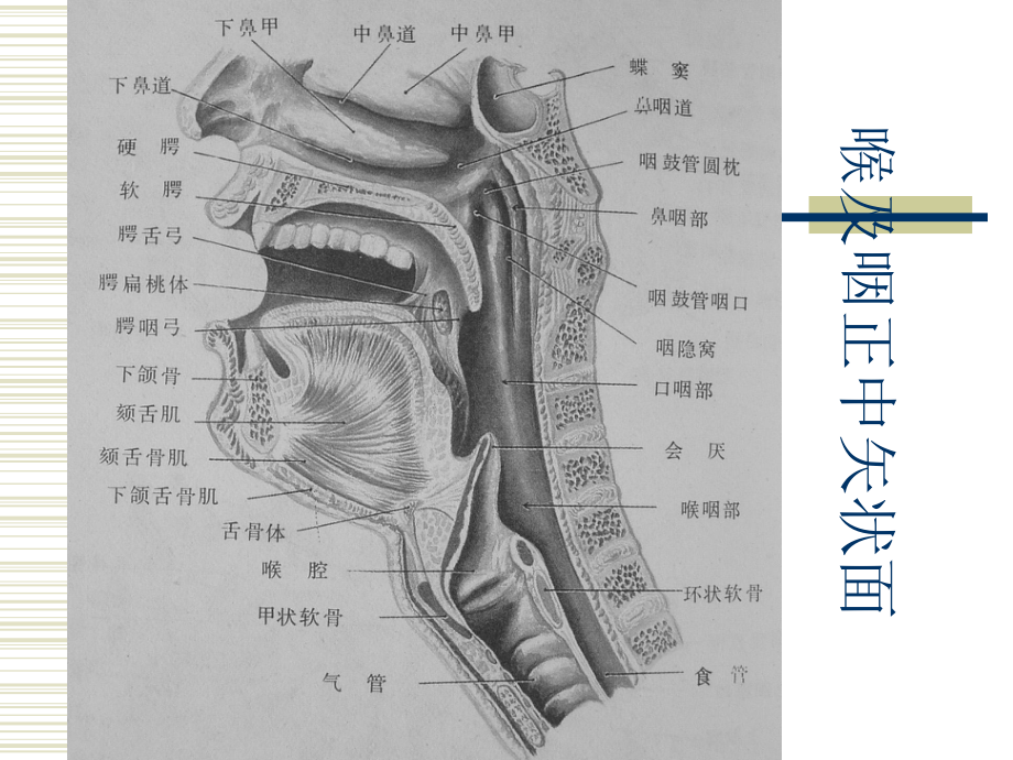 咽部疾病的CT表现课件.pptx_第3页