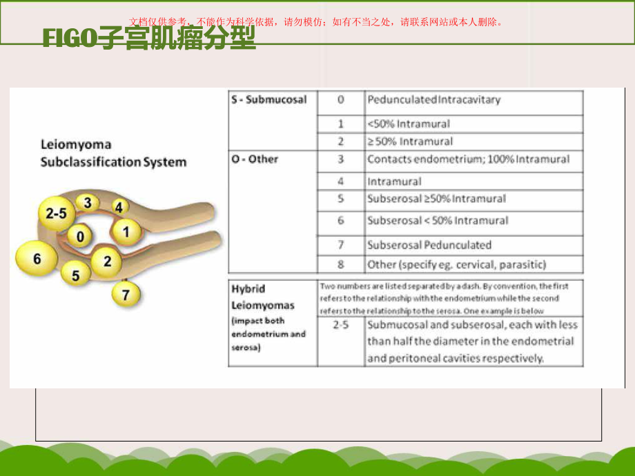 妊娠合并子宫肌瘤的处理课件.ppt_第3页