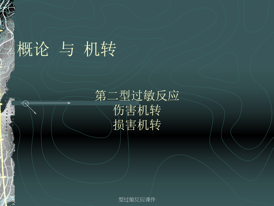 型过敏反应课件.ppt_第3页