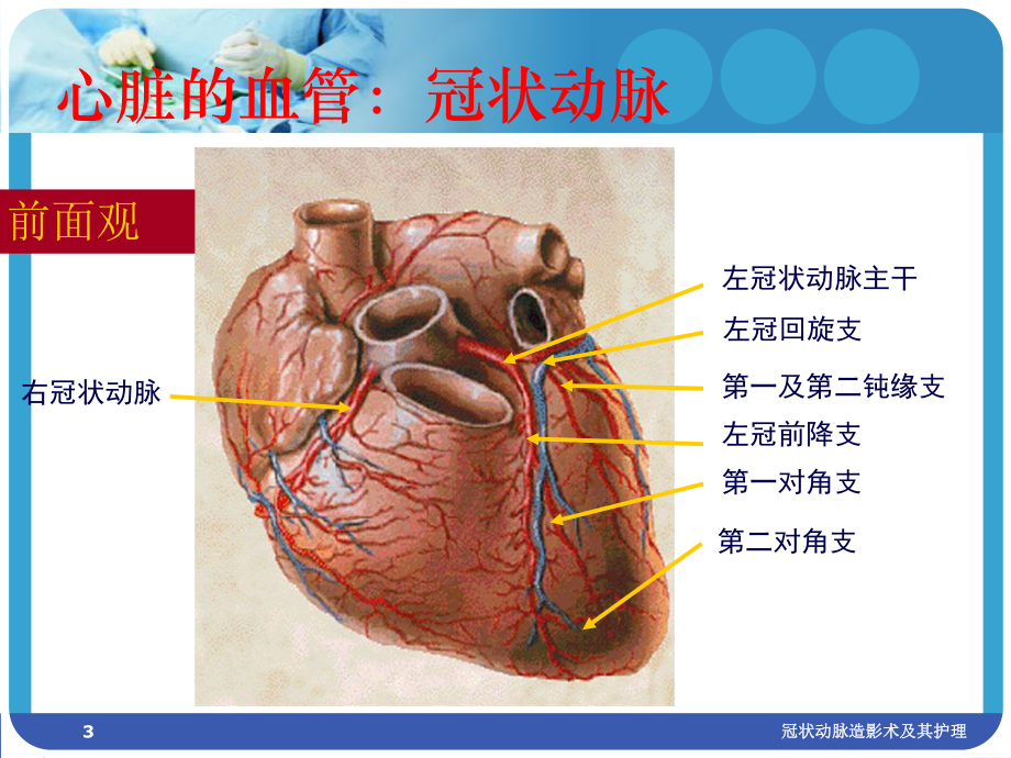 冠状动脉造影术及其护理培训课件.ppt_第3页