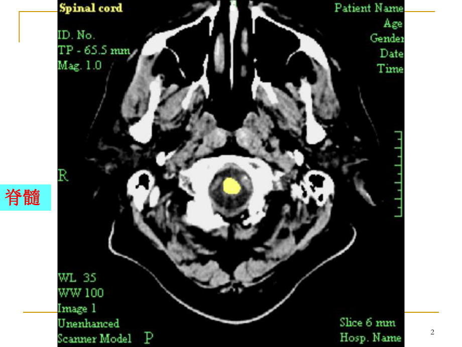 头颅CT读片教学课件.ppt_第2页