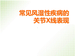 医学课件-风湿性疾病的影像学表现课件.ppt