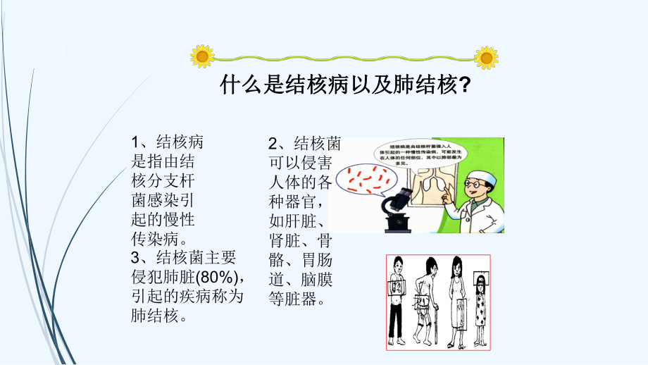 学生结核病防治知识宣传(中学)课件.ppt_第3页